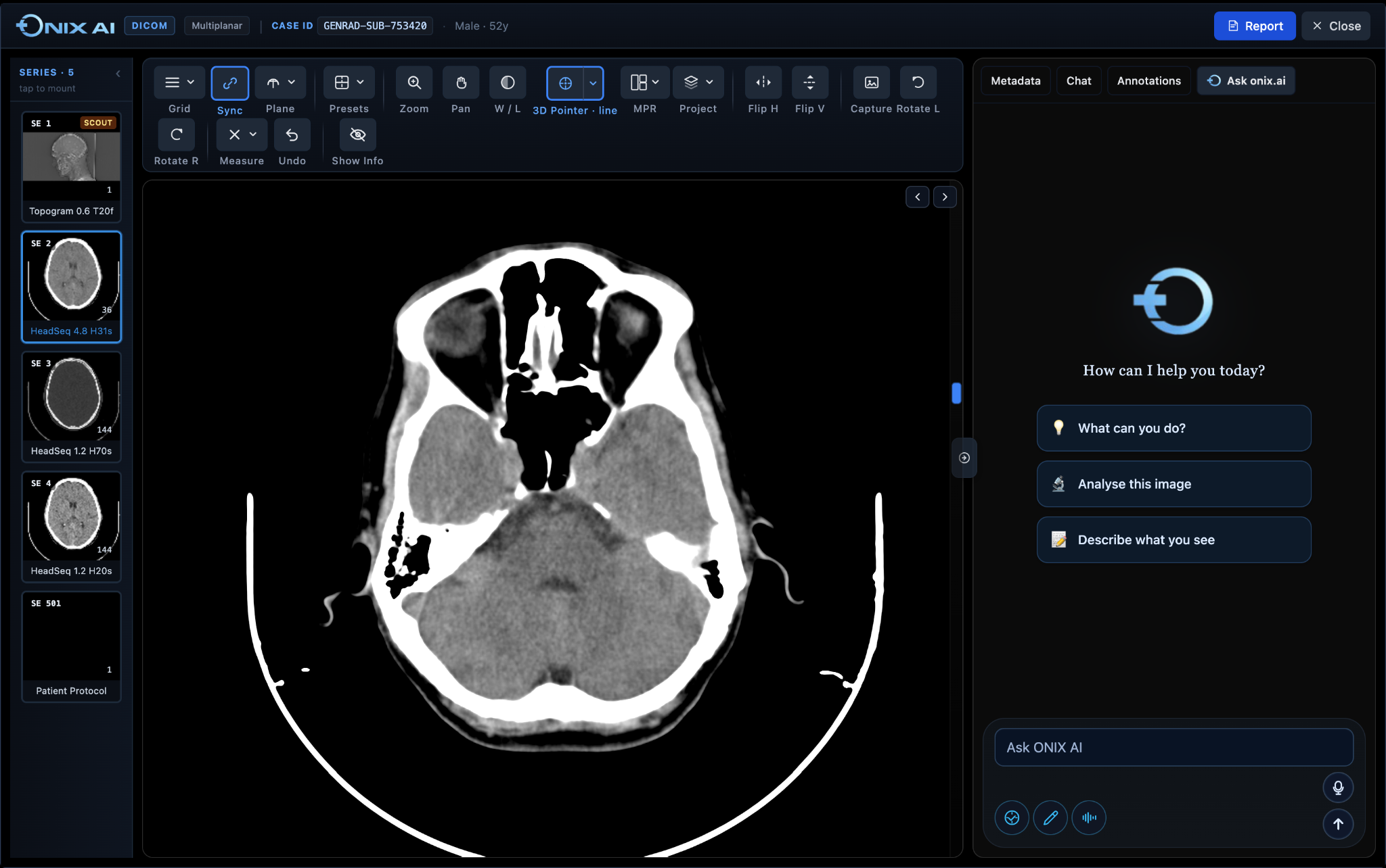 ONIX AI diagnostic viewer with CT series, measurement tools and Ask ONIX AI panel