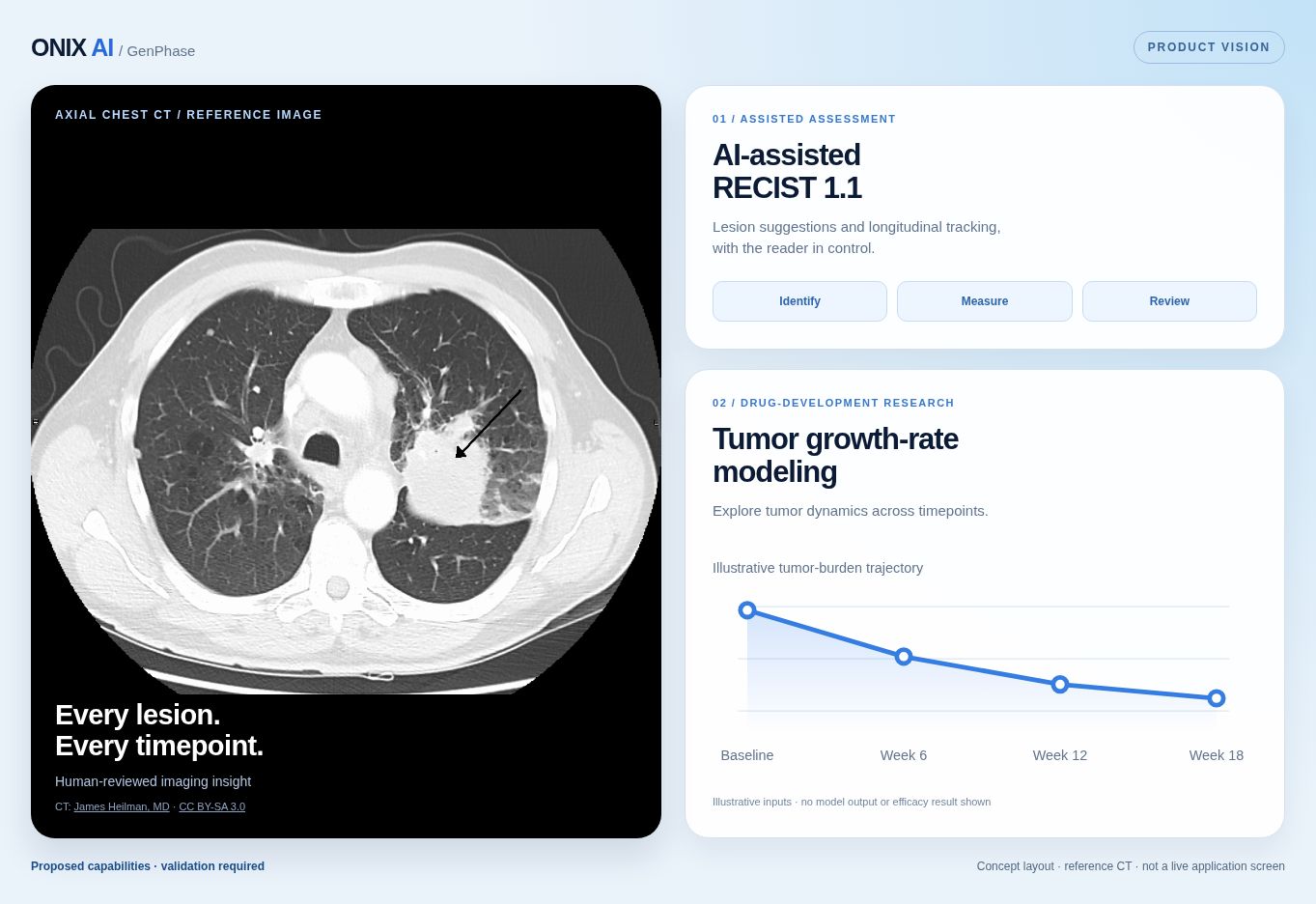 ONIX product vision: AI-assisted RECIST 1.1 and tumor growth-rate modeling. Concept illustration; proposed capabilities, not clinical results.