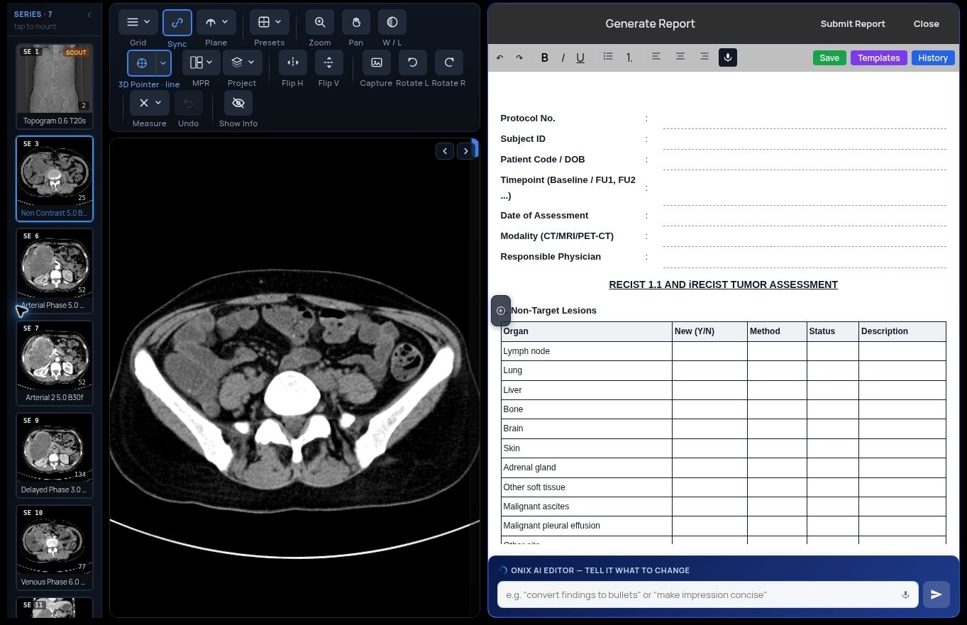 Actual reader workspace: CT viewer alongside the RECIST 1.1 / iRECIST report template. Identifying header cropped; organization-name placeholder editorially removed (live fix pending). Blank fields are shown as observed.